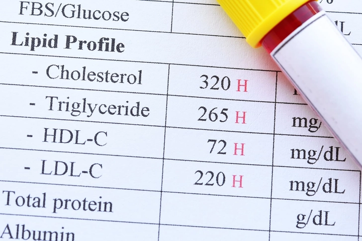 High Cholesterol High Cholesterol