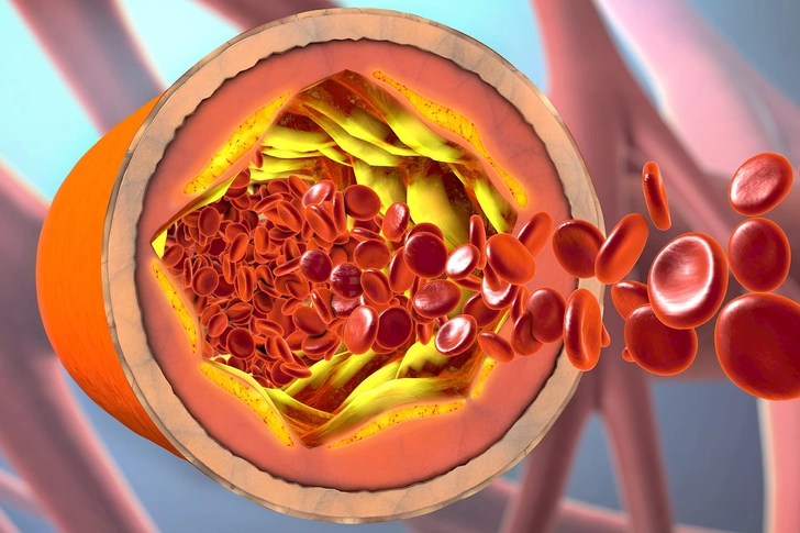 Heart Disease Heart Disease