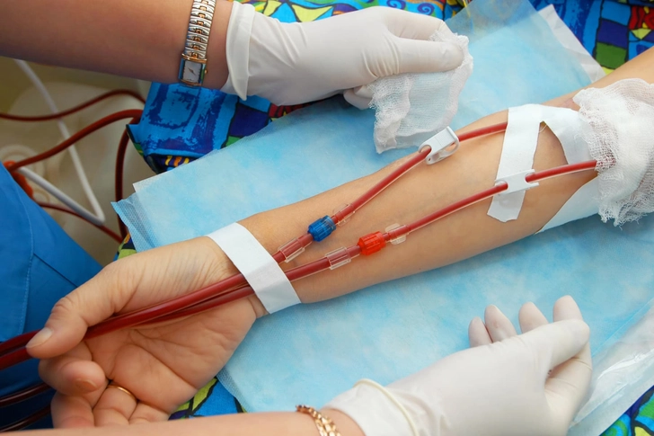 Chronic Kidney Failure