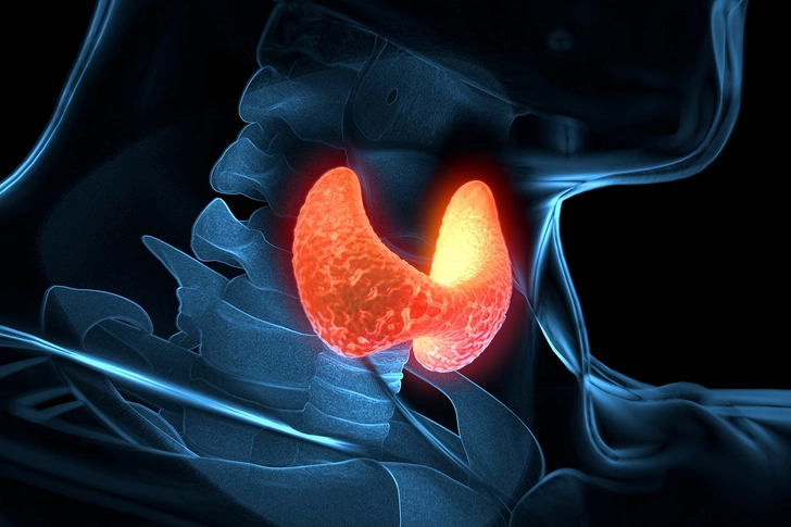 Hypothyroidism