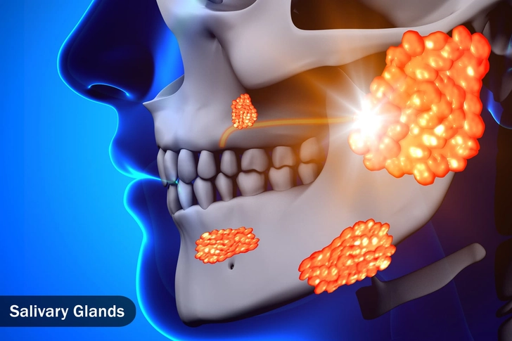 Salivary Gland Infection Salivary Gland Infection
