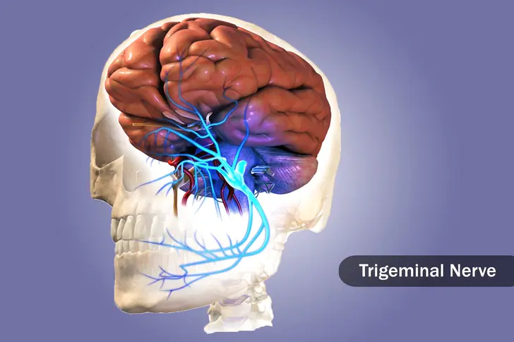 Trigeminal Neuralgia