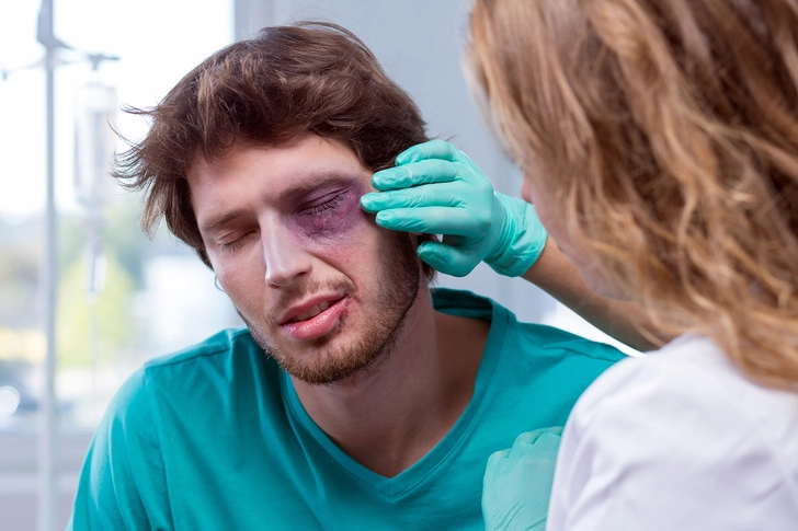Eye Injury