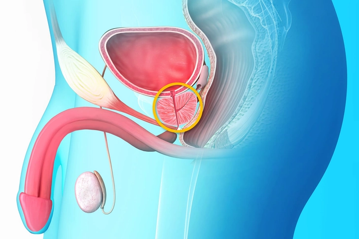 Prostatitis
