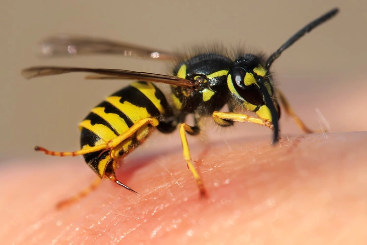 Bug Bite or Sting