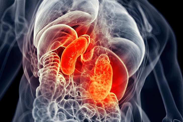 Kidney Disease Kidney Disease