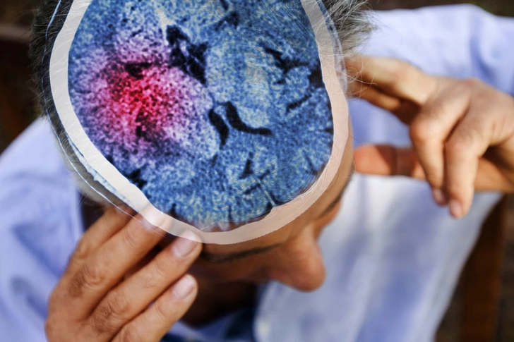 Brain Disorders Brain Disorders
