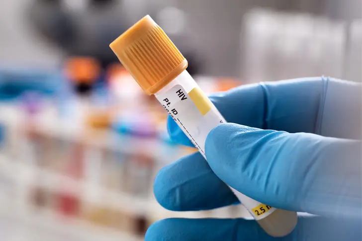 Viral Suppression in HIV Viral Suppression in HIV