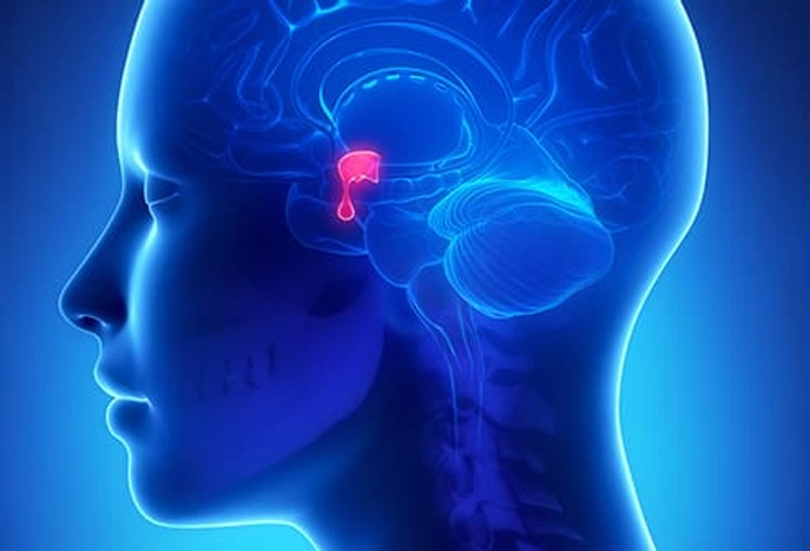 Hypopituitarism