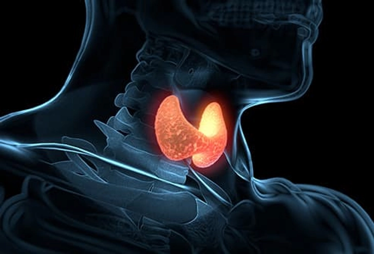 Hypothyroidism