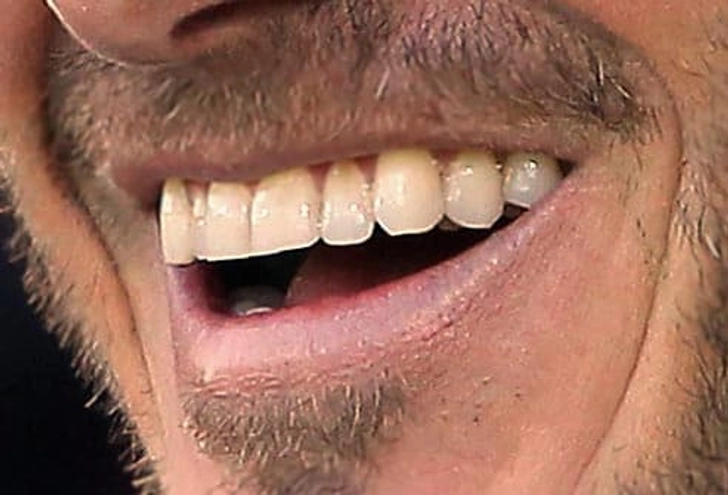A Kickin' Smile