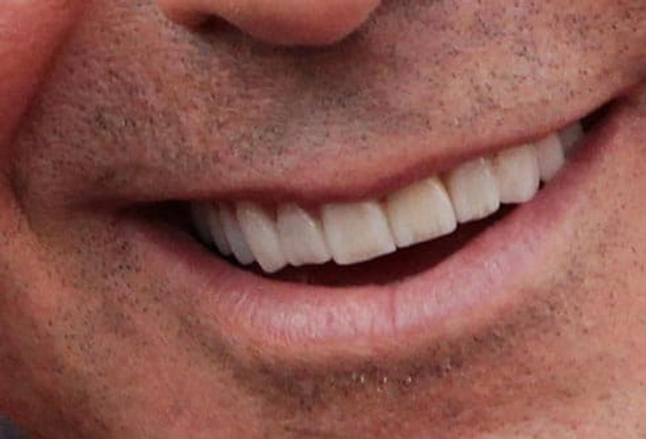 The Leading Man's Grin