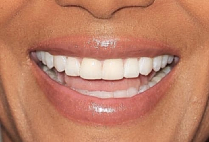 Most Popular Smile Most Popular Smile