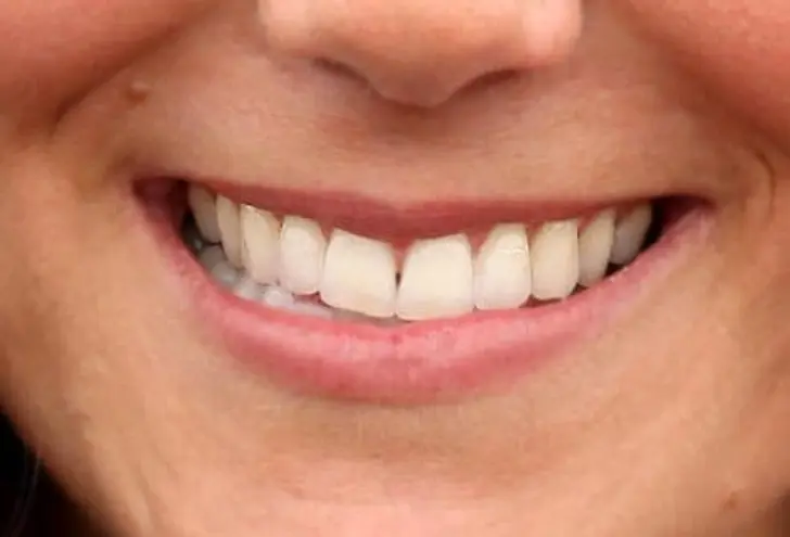 Smile Fit for Royalty