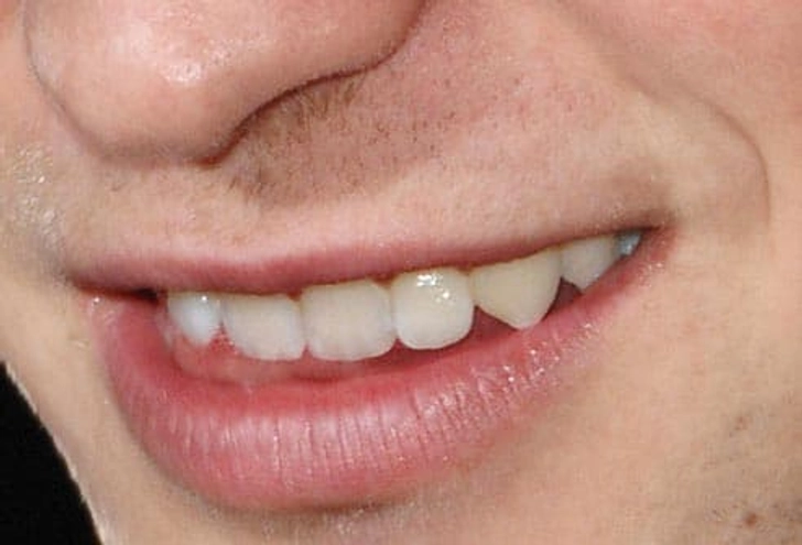 Heartthrob Pearly Whites