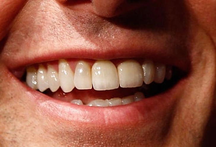 Perfect Smile? Mission Possible! Perfect Smile? Mission Possible!