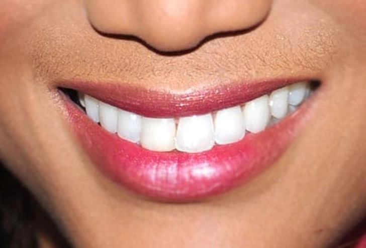 Many Model Smiles