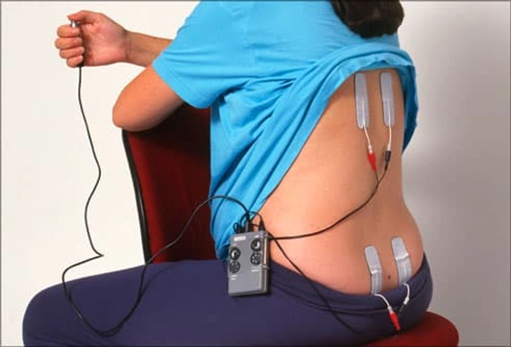 Nerve Stimulation Nerve Stimulation
