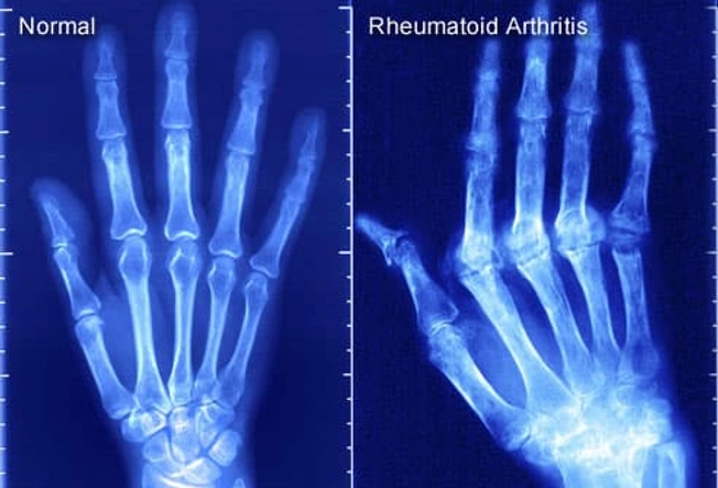 Imaging Tests You May Get