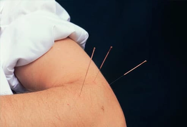 Các phương pháp điều trị khác Các phương pháp điều trị khác