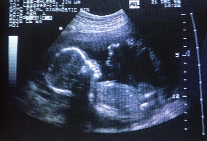 Discuss Before Pregnancy