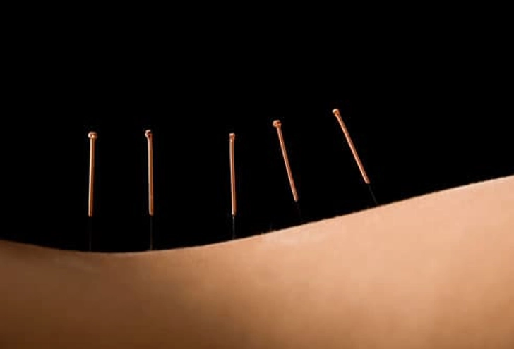 Complementary Therapies
