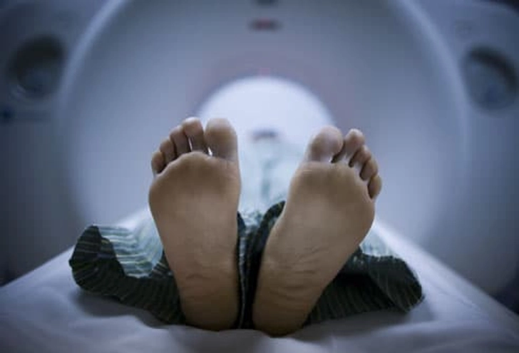 Diagnosing Sciatica: Imaging