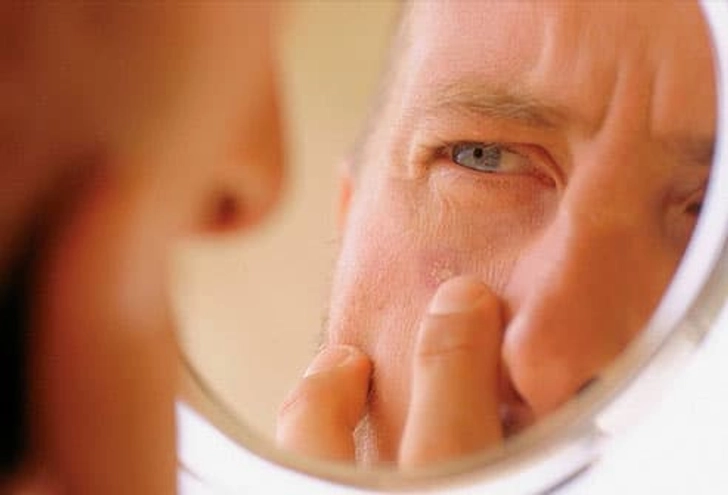 Screening for Skin Cancer