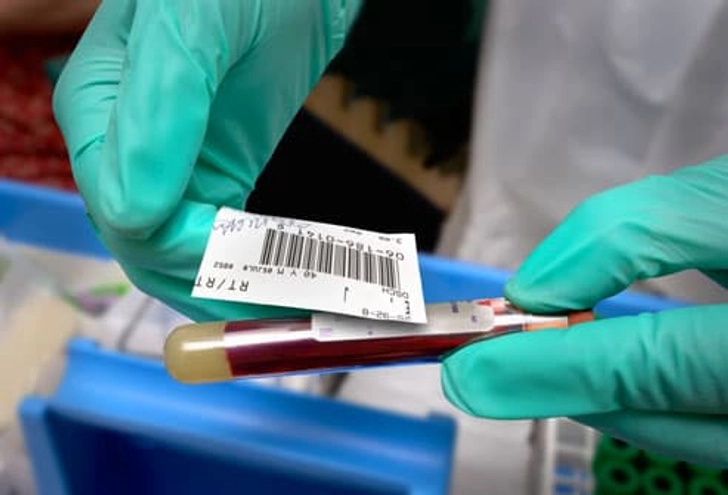 Checking Your Cholesterol