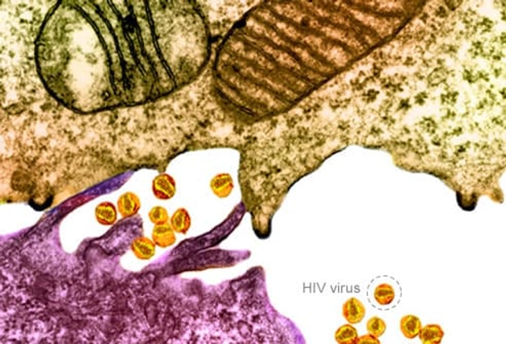 Human Immunodeficiency Virus (HIV) Human Immunodeficiency Virus (HIV)