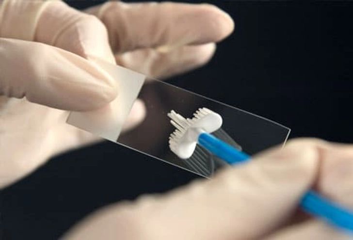 Screening for Cervical Cancer Screening for Cervical Cancer