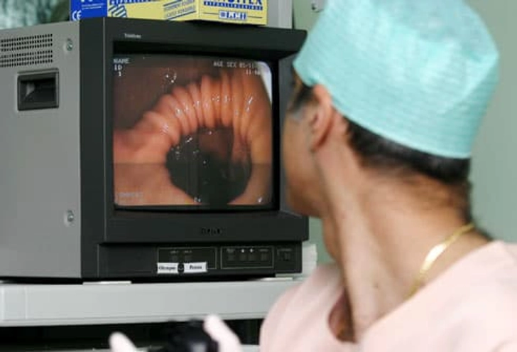 Screening for Colorectal Cancer Screening for Colorectal Cancer