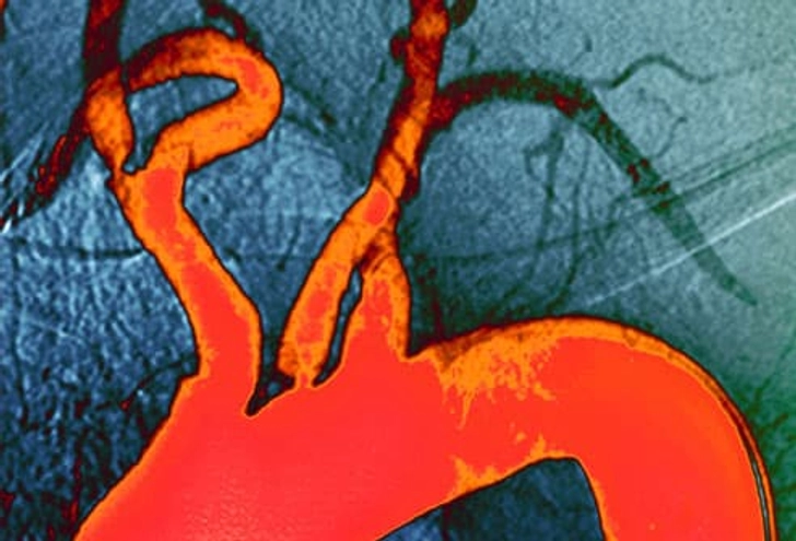 Cholesterol Levels Cholesterol Levels