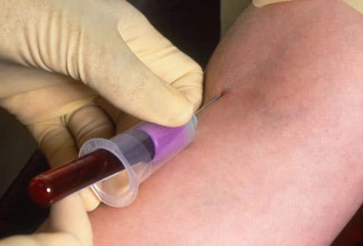 HIV Screening Tests HIV Screening Tests