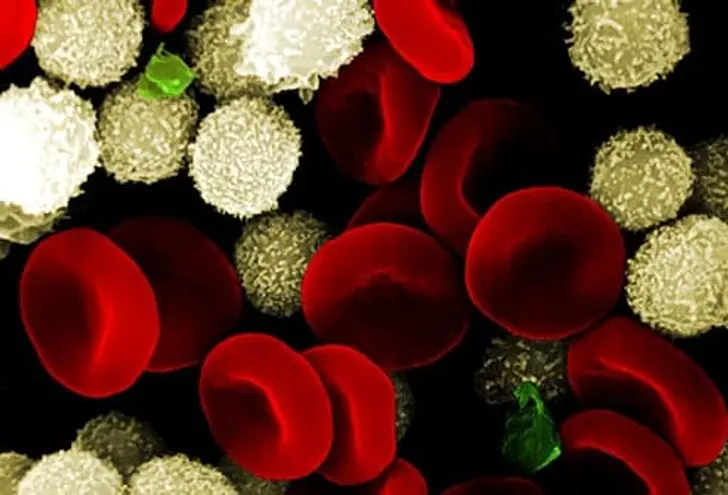Sepsis: The Basics