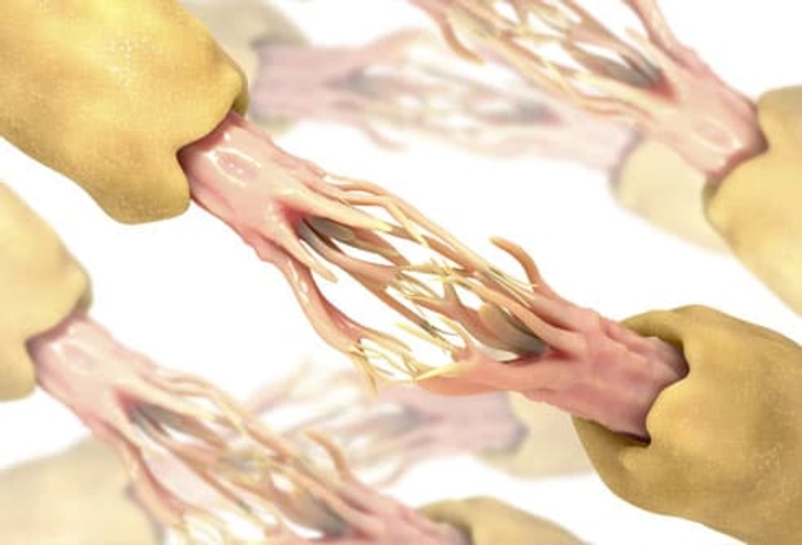 Can Shingles Cause Chronic Pain?