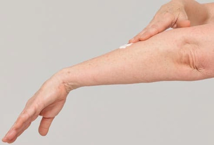 Treatment: Rash Relief