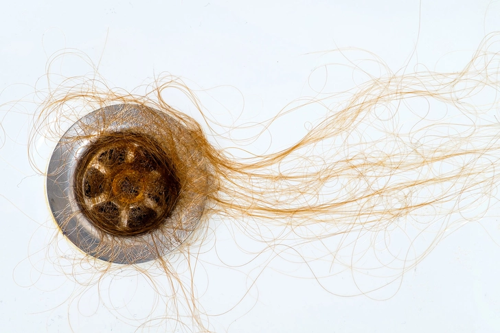 Hair Loss Hair Loss