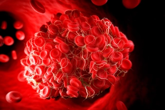  Kidney Transplant Reactions
