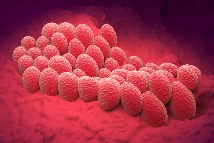 Endometrial (Uterine) Cancer Recurrence Endometrial (Uterine) Cancer Recurrence