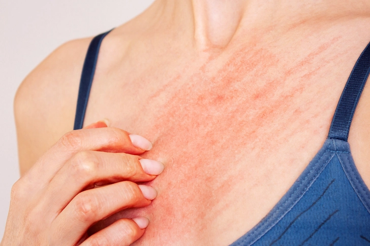 Itching That Won’t Go Away Itching That Won’t Go Away