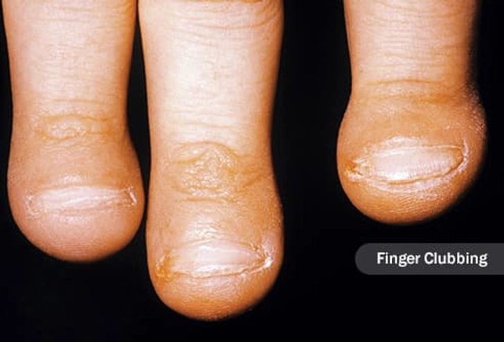 Fatter Fingertips Fatter Fingertips