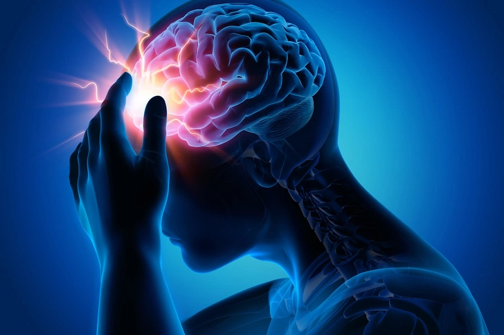 Headache