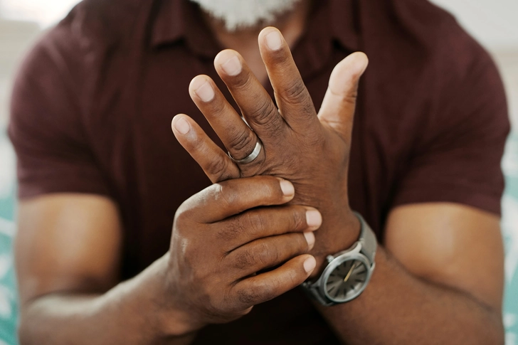 Arthritis