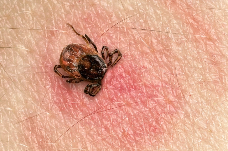 Lyme Disease