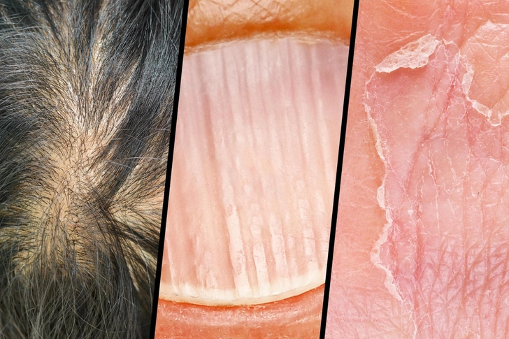 Hair, Nail, and Skin Problems