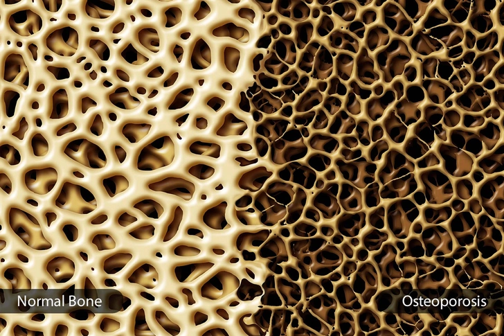 Calcium: Why You Need It