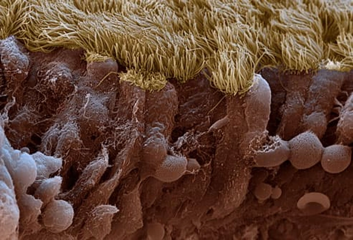 What Is Sinusitis?
