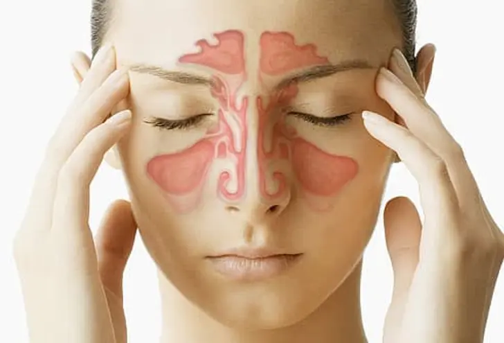 Sinus Attack!