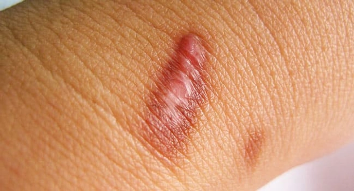 Show Your Scar Some TLC Show Your Scar Some TLC